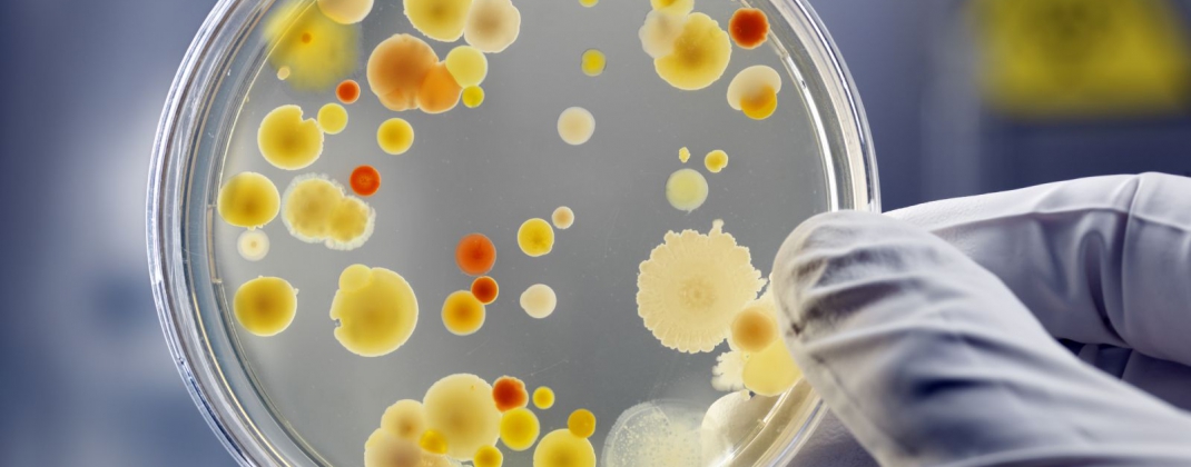Voedingshygiëne in school- en bedrijfskantines : microben opgekrast !