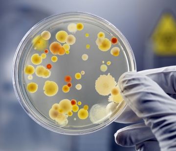 L’hygiène alimentaire dans les cantines et restaurants d'entreprise : débarrassons-nous des microbes ! 
